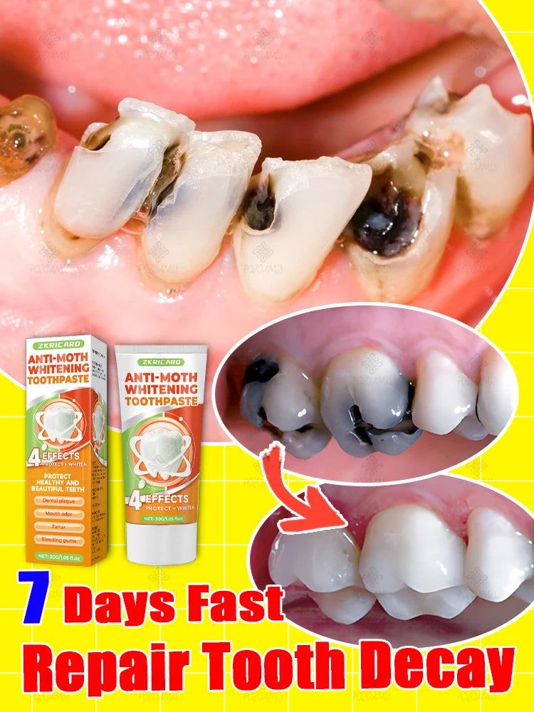 StrongBite Tooth Reshaper