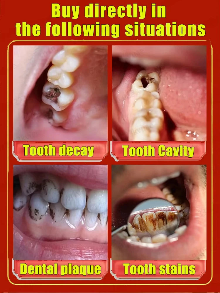 StrongBite Tooth Reshaper