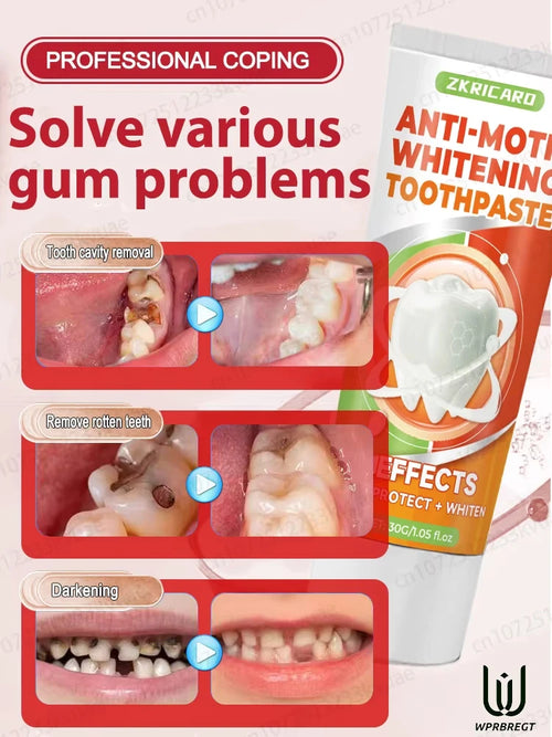 StrongBite Tooth Reshaper